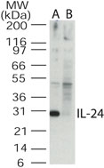 IL24 Antibody - Western blot of IL-24 in the A) absence and B) presence of blocking peptide in Jurkat cell lysate using antibody at 0.5 ug/ml.