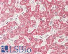 IL25 / IL17E Antibody - Human Liver: Formalin-Fixed, Paraffin-Embedded (FFPE)