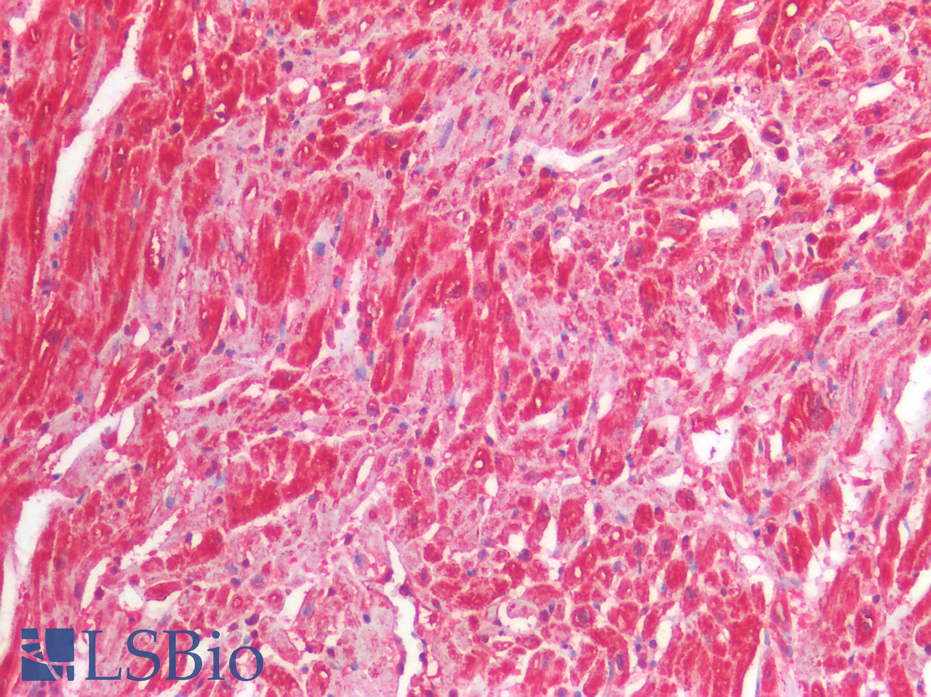 IL25 / IL17E Antibody - Human Heart: Formalin-Fixed, Paraffin-Embedded (FFPE)