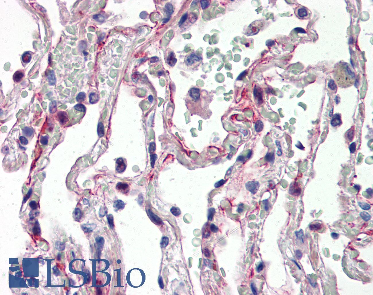 IL27 Antibody - Anti-IL-27 antibody IHC of human lung. Immunohistochemistry of formalin-fixed, paraffin-embedded tissue after heat-induced antigen retrieval. Antibody concentration 5 ug/ml.