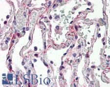 IL27 Antibody - Anti-IL-27 antibody IHC of human lung. Immunohistochemistry of formalin-fixed, paraffin-embedded tissue after heat-induced antigen retrieval. Antibody concentration 5 ug/ml.