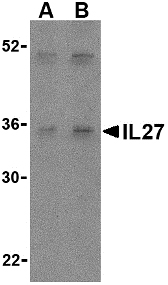 IL27 Antibody - Western blot of IL-27 in Daudi lysate with IL-27 antibody at (A) 2 and (B) 4 ug/ml.