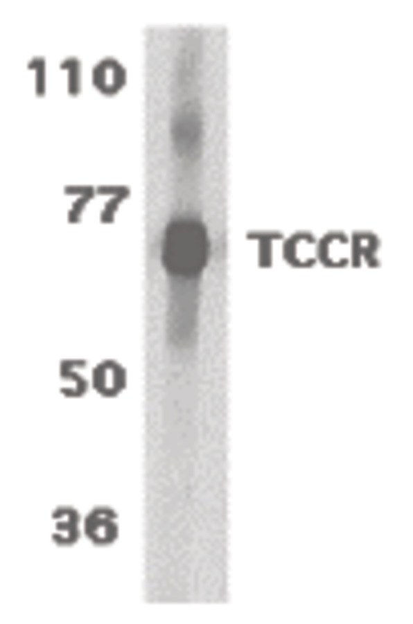 IL27RA Antibody - Western blot of TCCR expression in human spleen tissue lysates with TCCR antibody at 1 ug /ml.