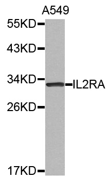 IL2RA / CD25 Antibody - Western blot analysis of extracts of A549 cell lysate.