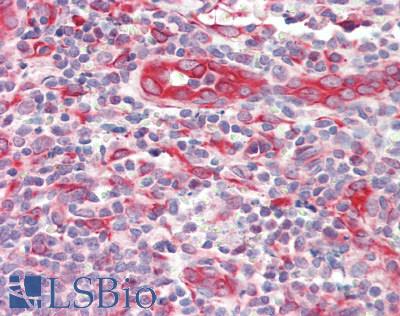 IL2RA / CD25 Antibody - Human Tonsil: Formalin-Fixed, Paraffin-Embedded (FFPE)