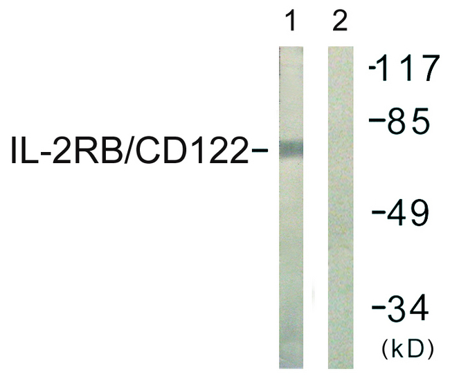 IL2RB / CD122 Antibody - Western blot analysis of lysates from COS7 cells, using IL-2R beta/CD122 Antibody. The lane on the right is blocked with the synthesized peptide.