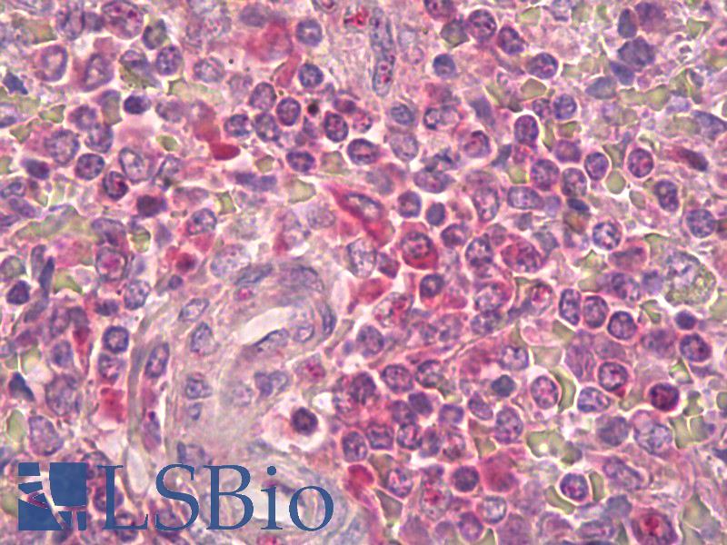 IL2RB / CD122 Antibody - Anti-IL2RB / CD122 antibody IHC of human spleen, periarterial lymphocytes. Immunohistochemistry of formalin-fixed, paraffin-embedded tissue after heat-induced antigen retrieval. Antibody dilution 1:67.