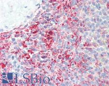 IL3 Antibody - Human Spleen: Formalin-Fixed, Paraffin-Embedded (FFPE), at a concentration of 10 ug/ml. 