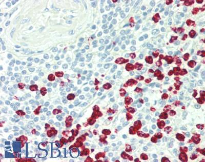 IL3 Antibody - Human Spleen: Formalin-Fixed, Paraffin-Embedded (FFPE)
