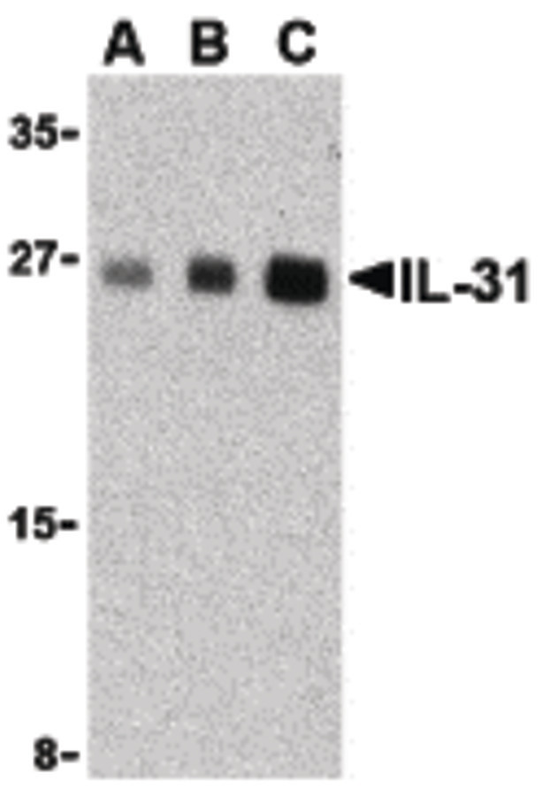 IL31 Antibody - Western blot of IL-31 in human skeletal muscle tissue lysate with IL-31 antibody at (A) 2.5, (B) 5 and (C) 10 ug/ml.
