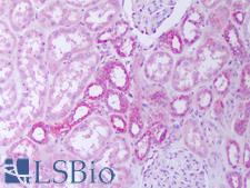 IL31 Antibody - Anti-IL-31 antibody IHC of human kidney, tubules. Immunohistochemistry of formalin-fixed, paraffin-embedded tissue after heat-induced antigen retrieval. Antibody concentration 5 ug/ml.
