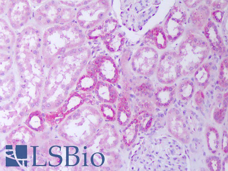 IL31 Antibody - Anti-IL-31 antibody IHC of human kidney, tubules. Immunohistochemistry of formalin-fixed, paraffin-embedded tissue after heat-induced antigen retrieval. Antibody concentration 5 ug/ml.
