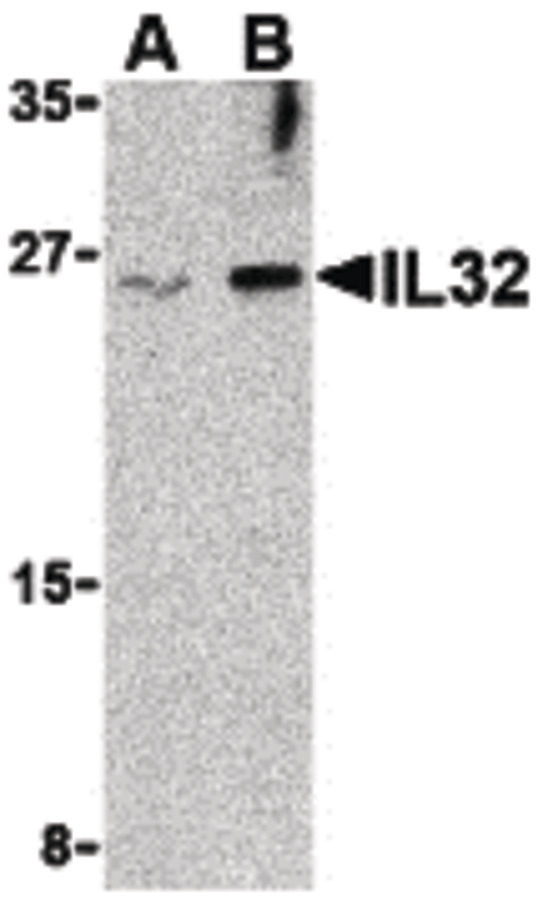 IL32 Antibody - Western blot of IL-32 in Jurkat cell lysate with IL-32 antibody at (A) 2.5 and (B) 5 ug/ml.