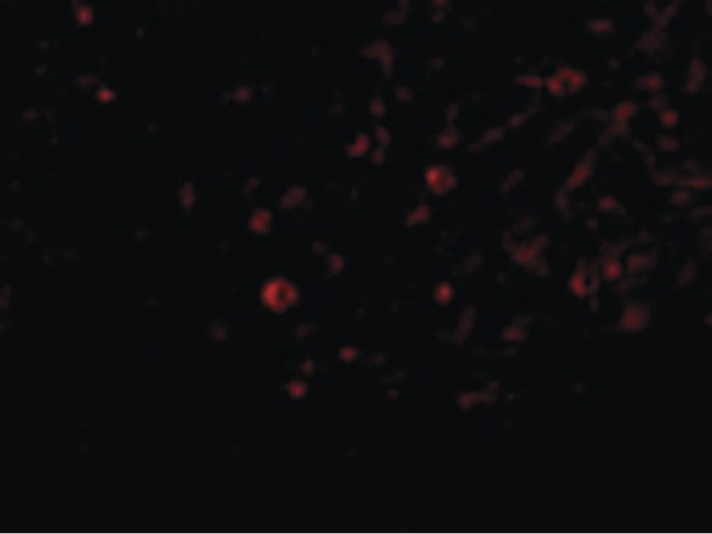 IL32 Antibody - Immunofluorescence of IL-32 in Human Spleen cells with IL-32 antibody at 20 ug/ml.
