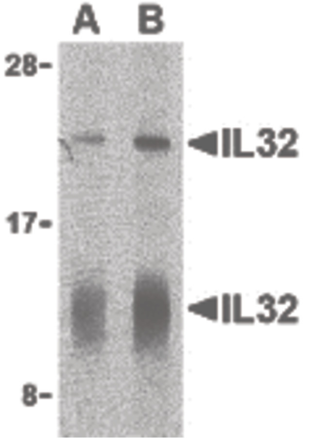 IL32 Antibody - Western blot of IL-32 in human spleen lysate with IL-32 antibody at (A) 5 and (B) 10 ug/ml shows two isoforms of IL-32.