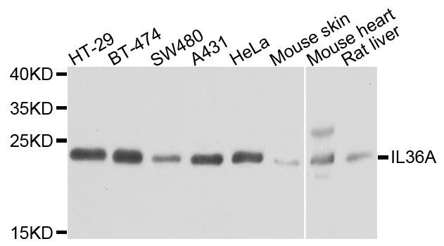 IL36A Antibody - Western blot blot of extracts of various cells, using IL36A antibody.
