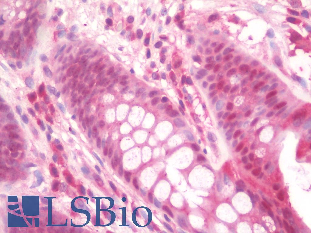 IL36B Antibody - Anti-IL36B antibody IHC staining of human colon. Immunohistochemistry of formalin-fixed, paraffin-embedded tissue after heat-induced antigen retrieval. Antibody concentration 10 ug/ml.