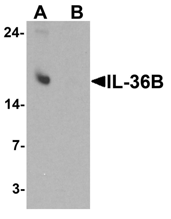 IL36B Antibody - Western blot analysis of IL-36B in A549 cell lysate with IL-36B antibody at 1 ug/ml in (A) the absence and (B) the presence of blocking peptide.