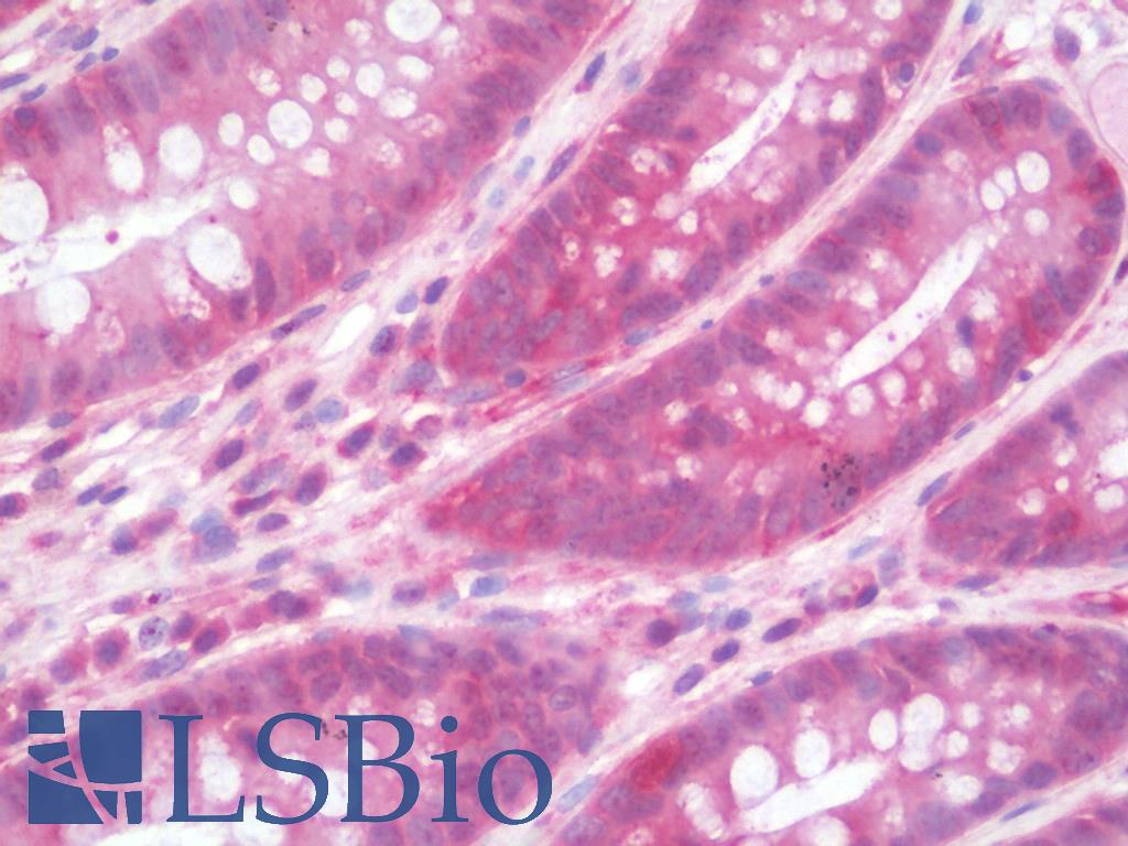 IL36RN / IL1F5 Antibody - Anti-IL36RN / IL1F5 antibody IHC staining of human colon. Immunohistochemistry of formalin-fixed, paraffin-embedded tissue after heat-induced antigen retrieval. Antibody concentration 10 ug/ml.