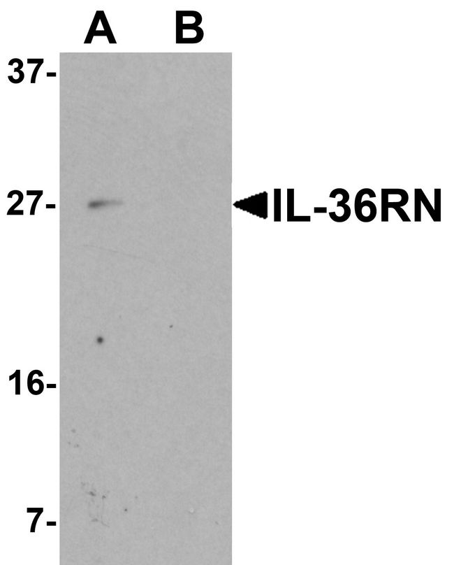IL36RN / IL1F5 Antibody - Western blot analysis of IL-36RN in 3T3 cell lysate with IL-36RN antibody at 1 ug/ml in (A) the absence and (B) the presence of blocking peptide.