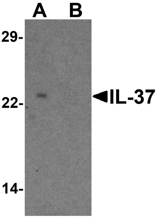 IL37 Antibody - Western blot analysis of IL-37 in human lung tissue lysate with IL-37 antibody at 1 ug/ml in (A) the presence and (B) the absence of blocking peptide.
