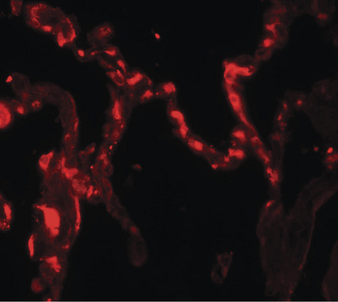 IL37 Antibody - Immunofluorescence of IL-12A in human kidney tissue with IL-12A antibody at 20 ug/ml.