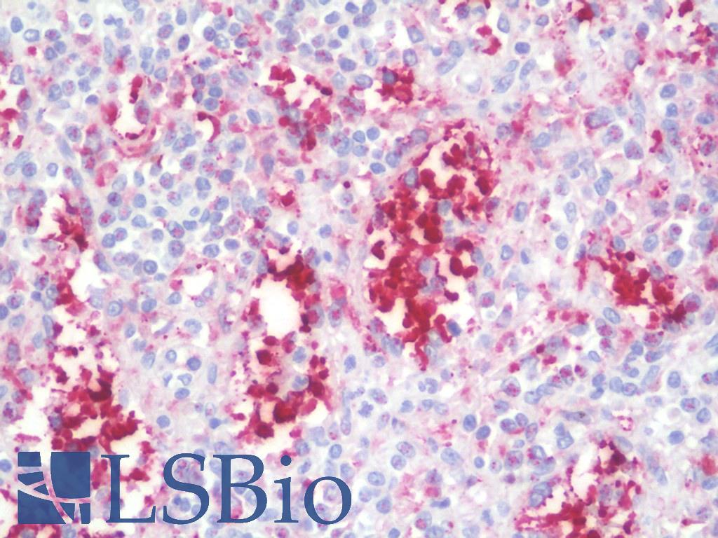IL37 Antibody - Anti-IL37 antibody IHC staining of human spleen. Immunohistochemistry of formalin-fixed, paraffin-embedded tissue after heat-induced antigen retrieval. Antibody concentration 10 ug/ml.