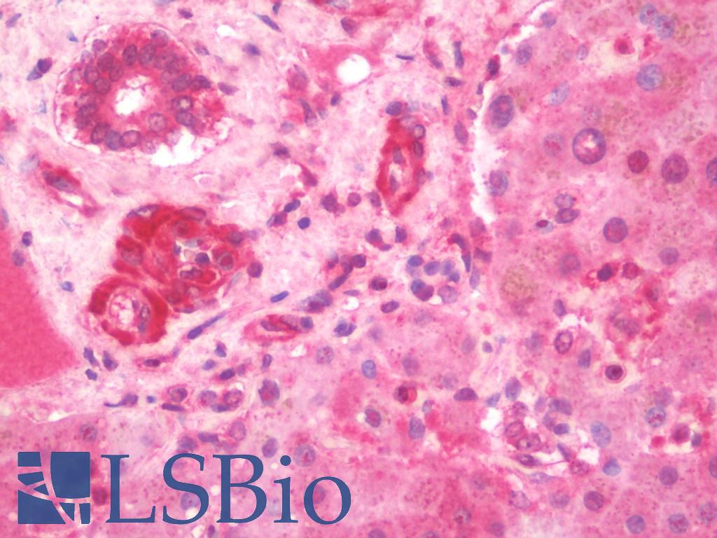 IL3RA / CD123 Antibody - Anti-IL3RA / CD123 antibody IHC staining of human liver. Immunohistochemistry of formalin-fixed, paraffin-embedded tissue after heat-induced antigen retrieval.