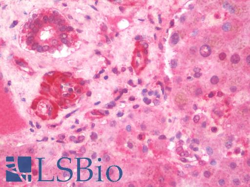 IL3RA / CD123 Antibody - Anti-IL3RA / CD123 antibody IHC staining of human liver. Immunohistochemistry of formalin-fixed, paraffin-embedded tissue after heat-induced antigen retrieval.