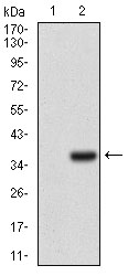 IL3RA / CD123 Antibody - Western blot using IL3RA monoclonal antibody against HEK293 (1) and IL3RA (AA: 200-305)-hIgGFc transfected HEK293 (2) cell lysate.