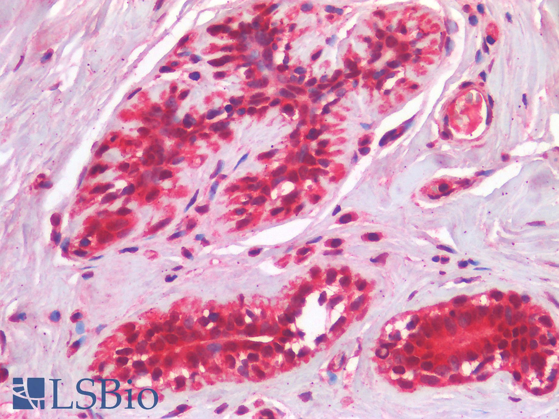 IL3RA / CD123 Antibody - Human Breast: Formalin-Fixed, Paraffin-Embedded (FFPE)