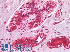 IL3RA / CD123 Antibody - Human Breast: Formalin-Fixed, Paraffin-Embedded (FFPE)