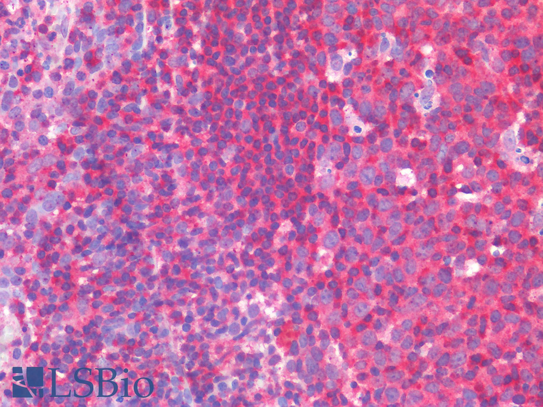 IL3RA / CD123 Antibody - Human Tonsil: Formalin-Fixed, Paraffin-Embedded (FFPE)