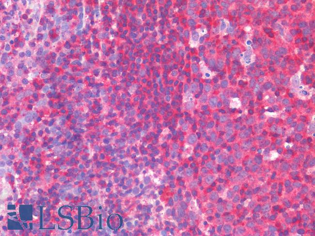 IL3RA / CD123 Antibody - Human Tonsil: Formalin-Fixed, Paraffin-Embedded (FFPE)