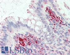 IL3RA / CD123 Antibody - Human Colon: Formalin-Fixed, Paraffin-Embedded (FFPE)