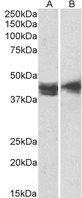 IL3RA / CD123 Antibody - IL3RA / CD123 antibody (2µg/ml) staining of Jurkat (A) and Molt4 (B) lysates (35µg protein in RIPA buffer). Detected by chemiluminescence.