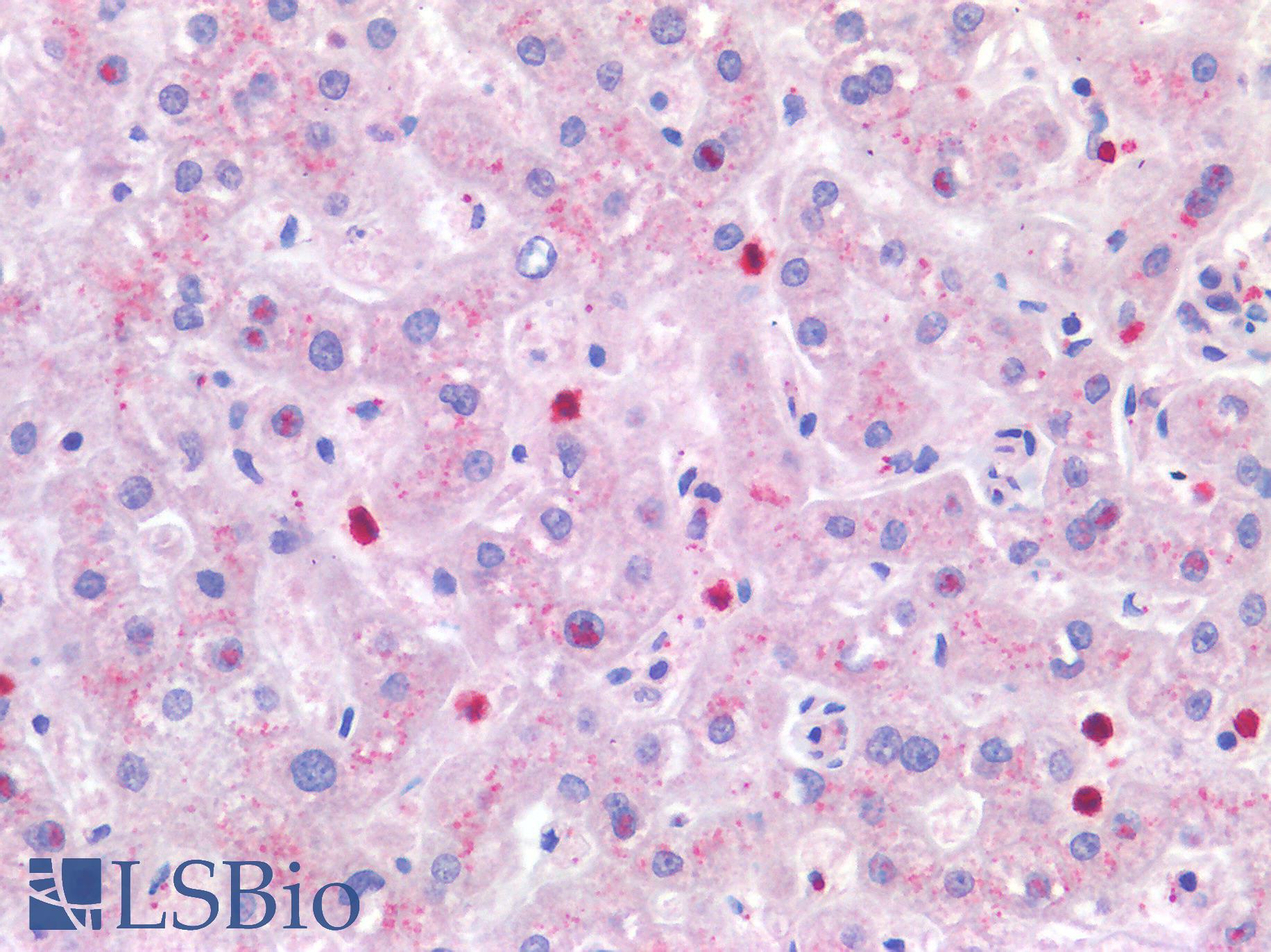 IL4 Antibody - Human Liver: Formalin-Fixed, Paraffin-Embedded (FFPE)