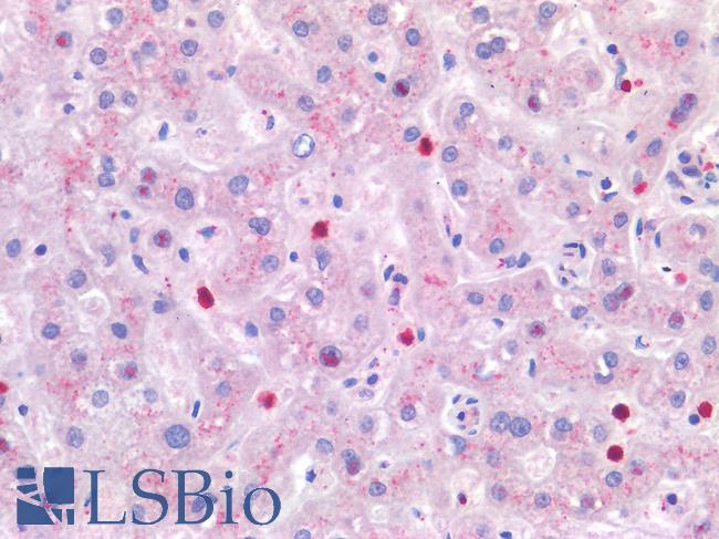 IL4 Antibody - Human Liver: Formalin-Fixed, Paraffin-Embedded (FFPE)