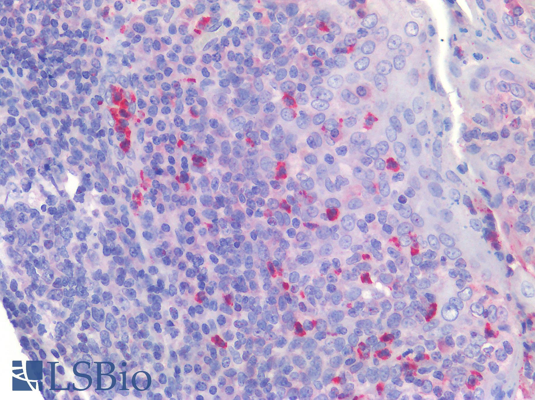 IL4 Antibody - Human Tonsil: Formalin-Fixed, Paraffin-Embedded (FFPE)