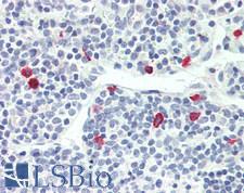 IL4 Antibody - Human Tonsil: Formalin-Fixed, Paraffin-Embedded (FFPE)