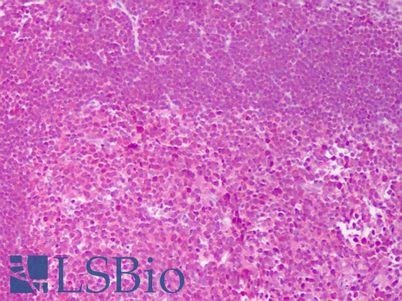 IL4 Antibody - Anti-IL-4 antibody IHC of human tonsil. Immunohistochemistry of formalin-fixed, paraffin-embedded tissue after heat-induced antigen retrieval. Antibody concentration 5 ug/ml.