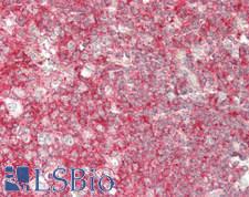 IL5 Antibody - Human Tonsil: Formalin-Fixed, Paraffin-Embedded (FFPE)