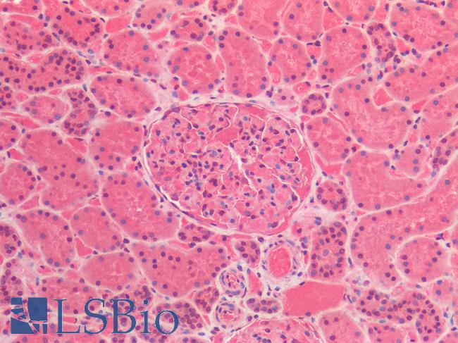 IL6 / Interleukin 6 Antibody - Human Kidney: Formalin-Fixed, Paraffin-Embedded (FFPE)