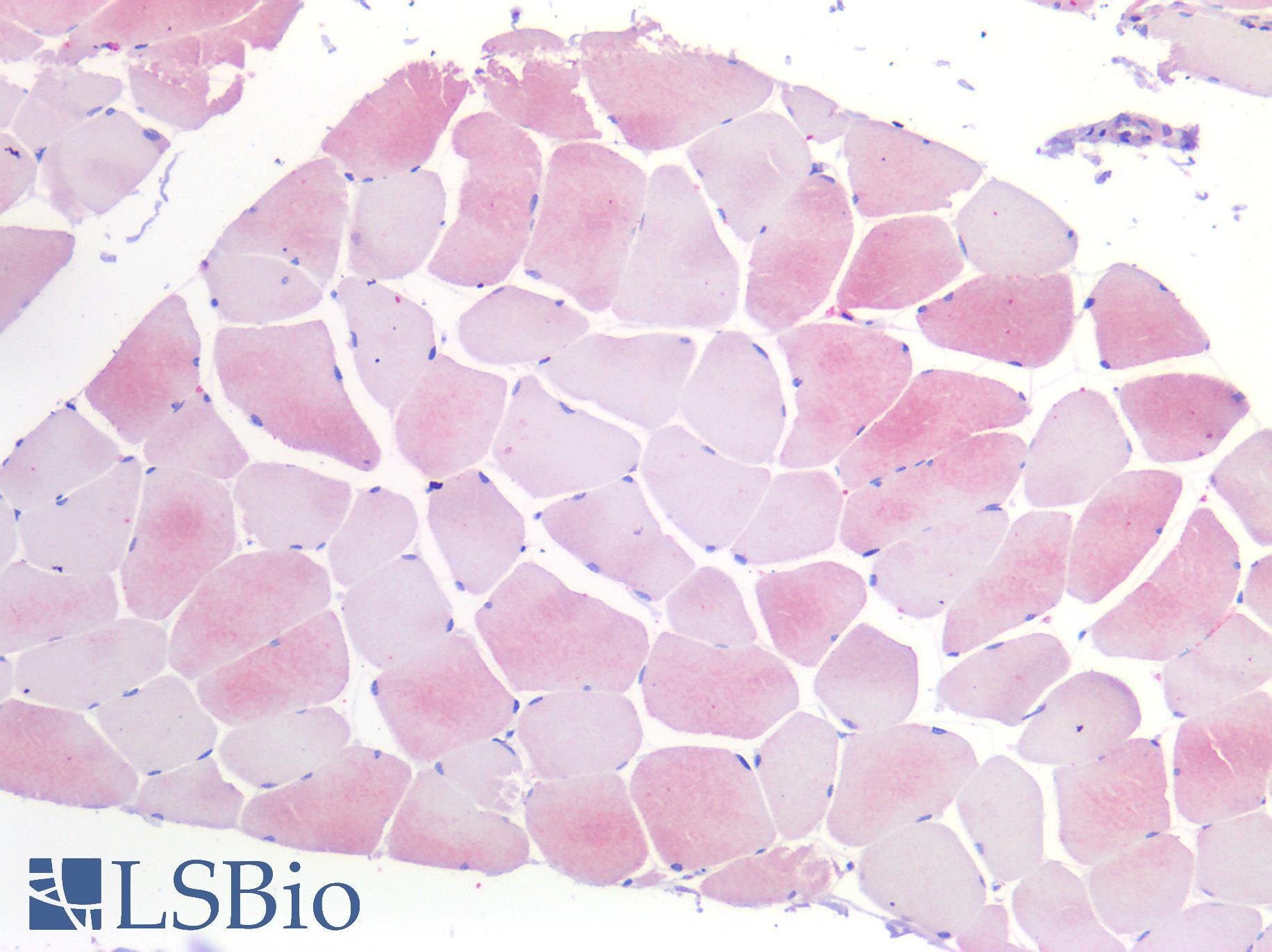 IL6R / IL6 Receptor Antibody - Human Skeletal Muscle: Formalin-Fixed, Paraffin-Embedded (FFPE)