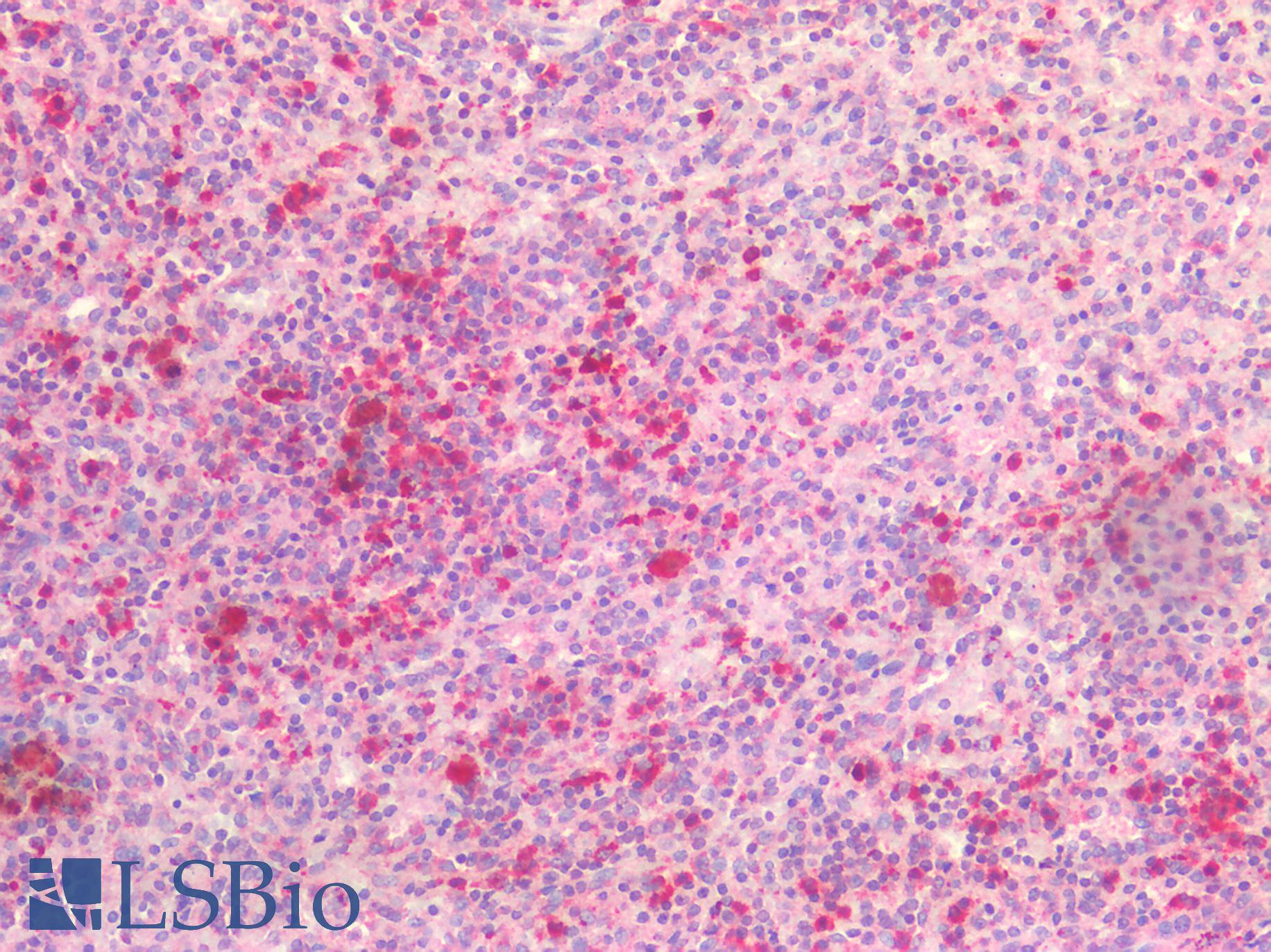 IL6R / IL6 Receptor Antibody - Human Spleen: Formalin-Fixed, Paraffin-Embedded (FFPE)