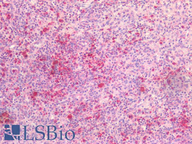 IL6R / IL6 Receptor Antibody - Human Spleen: Formalin-Fixed, Paraffin-Embedded (FFPE)