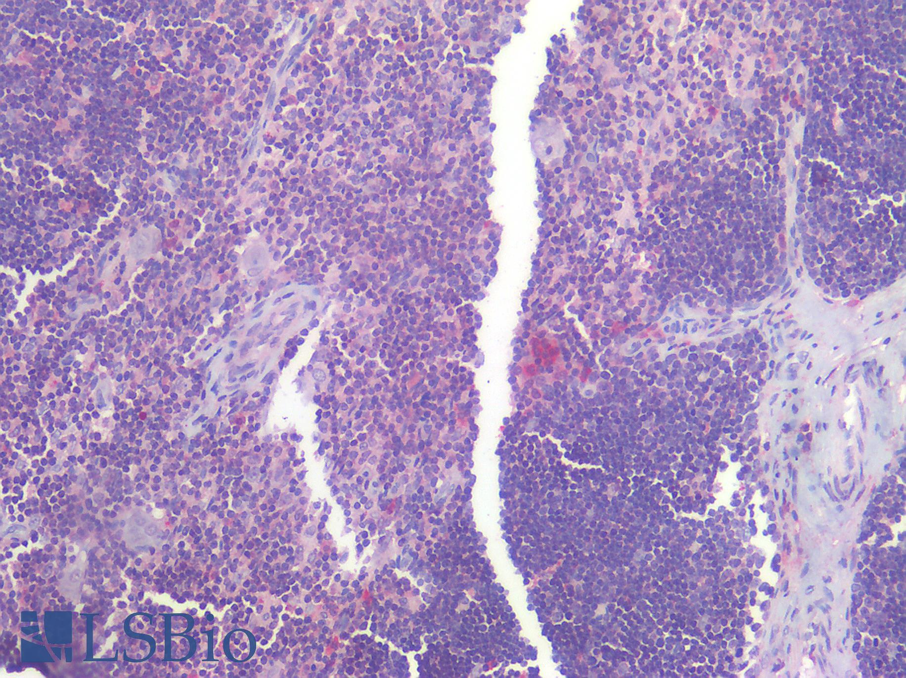 IL6R / IL6 Receptor Antibody - Human Thymus: Formalin-Fixed, Paraffin-Embedded (FFPE)