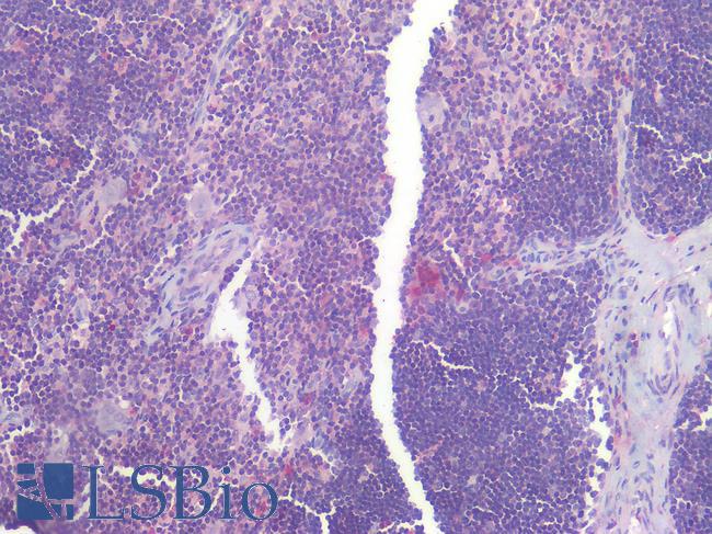 IL6R / IL6 Receptor Antibody - Human Thymus: Formalin-Fixed, Paraffin-Embedded (FFPE)