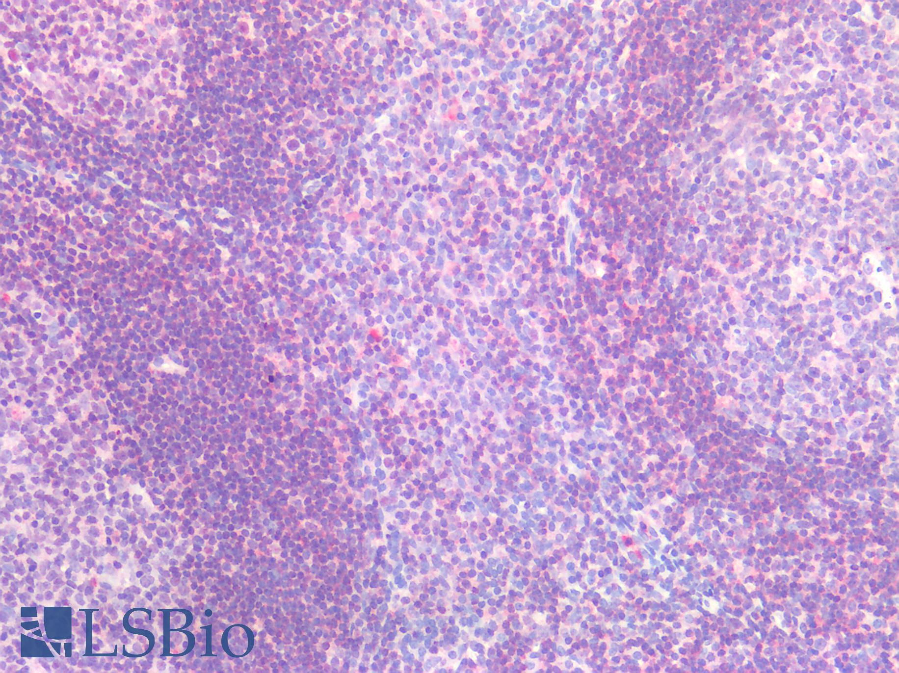 IL6R / IL6 Receptor Antibody - Human Tonsil: Formalin-Fixed, Paraffin-Embedded (FFPE)