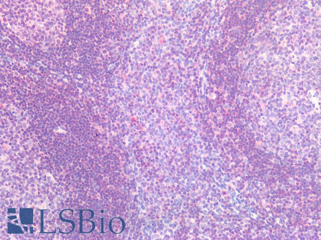 IL6R / IL6 Receptor Antibody - Human Tonsil: Formalin-Fixed, Paraffin-Embedded (FFPE)